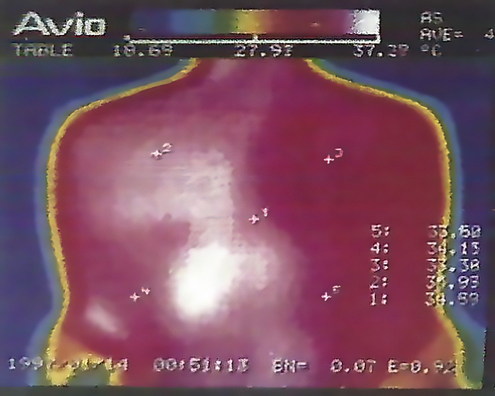 원적외선 투과 전 상태 Before Extreme infrared radiation
